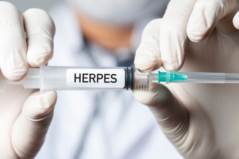 Herpes Impfung