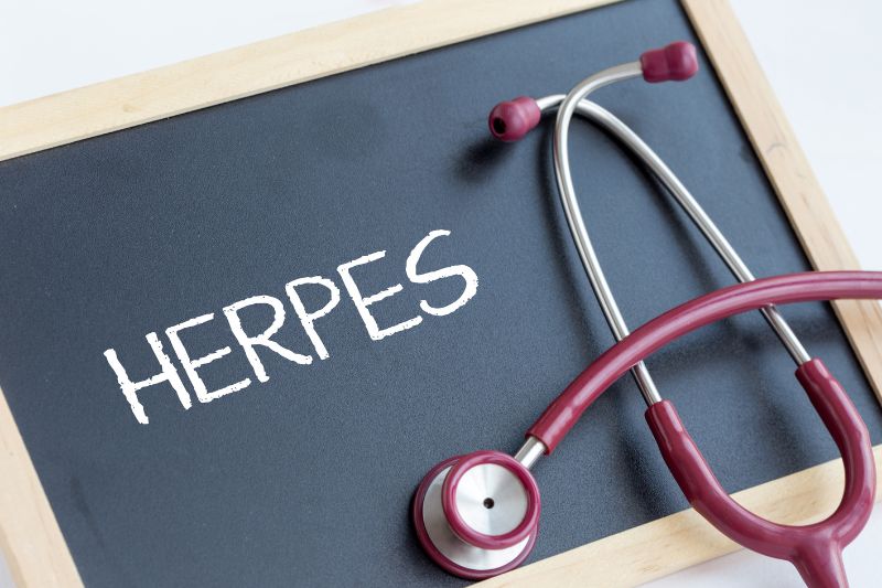 Herpes beim Pferd